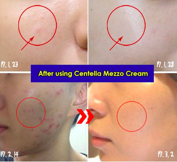 FC655 Medipeel Regeneration Skin Cream