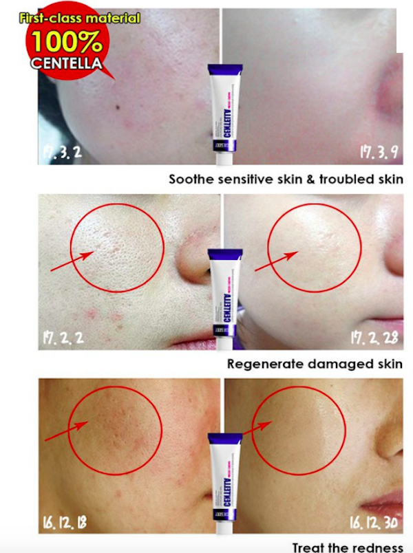 FC655 Medipeel Regeneration Skin Cream