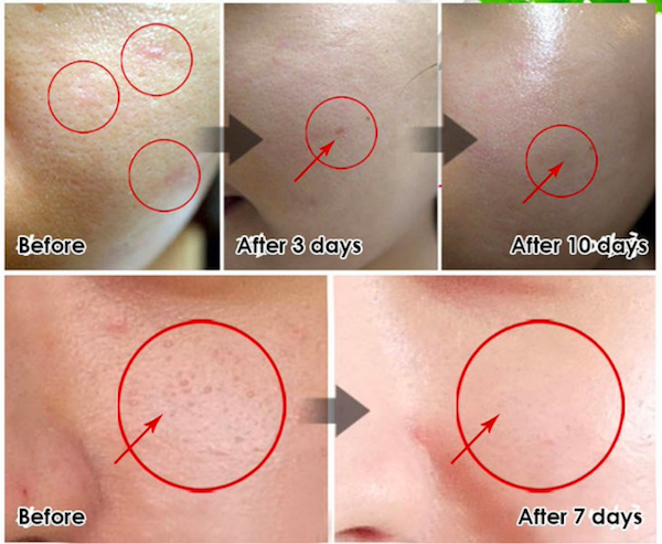 FC655 Medipeel Regeneration Skin Cream