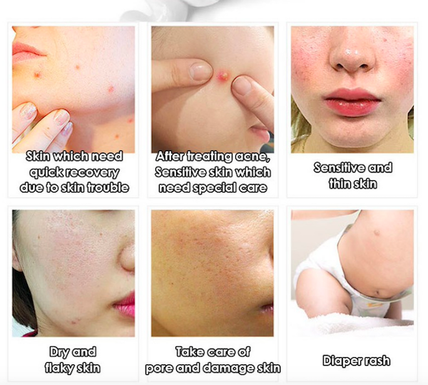FC655 Medipeel Regeneration Skin Cream