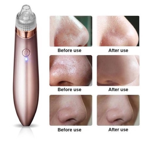 MK039 Blackhead Cleaner Rose